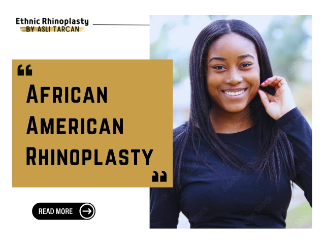 African American Rhinoplasty