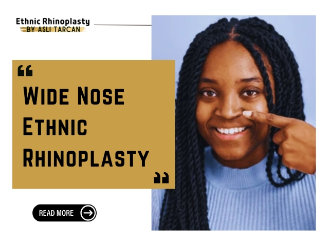 Wide Nose Ethnic Rhinoplasty