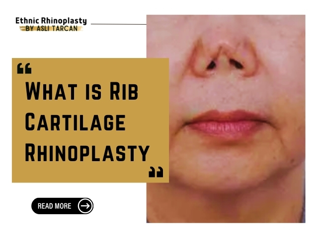 What is Rib Cartilage Rhinoplasty