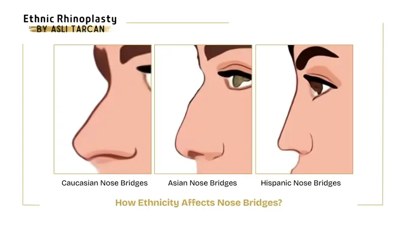 How Ethnicity Affects Nose Bridges How Ethnicity Affects Nose Bridges