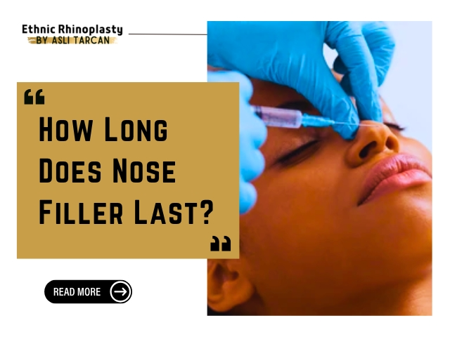 How Long Does Nose Filler Last