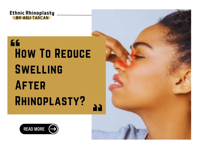 How To Reduce Swelling After Rhinoplasty