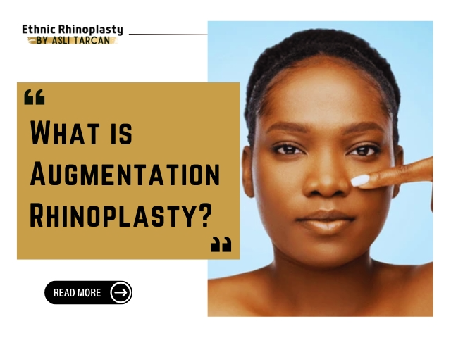 What is Augmentation Rhinoplasty