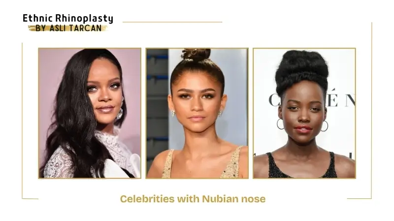 Celebrities with Nubian Nose Celebrities with Nubian Nose