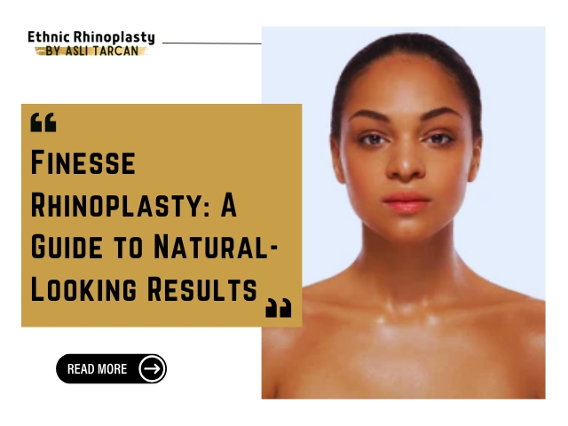 Finesse Rhinoplasty A Guide to Natural-Looking Results
