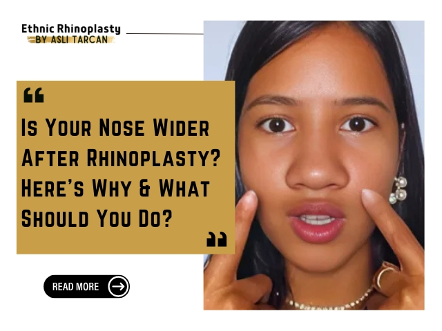 Nose Wider After Rhinoplasty