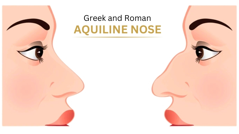 The History of Aquiline Nose The History of Aquiline Nose