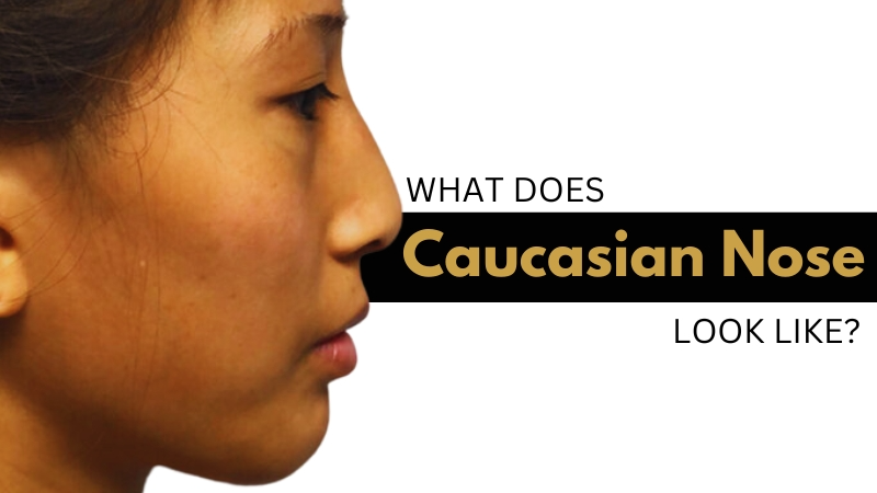 What Does Caucasian Nose Look Like
