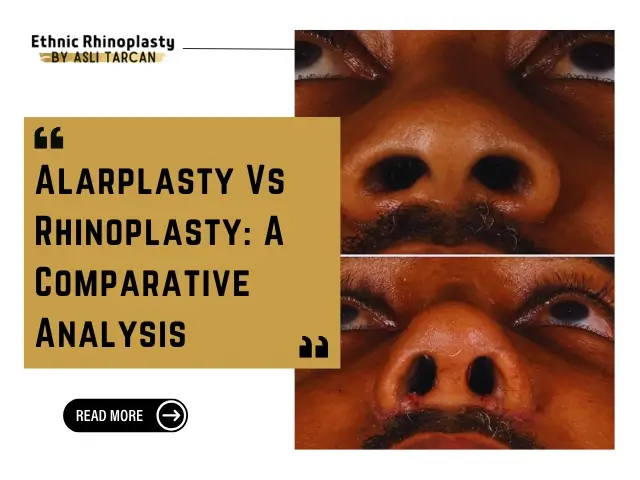 Alarplasty Vs Rhinoplasty