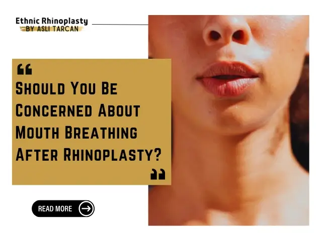 Mouth Breathing After Rhinoplasty