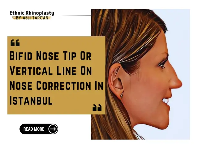 Bifid Nose Tip Or Vertical Line On Nose Correction In Istanbul