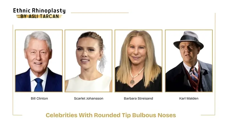 Celebrities With Rounded Tip Bulbous Noses Celebrities With Rounded Tip Bulbous Noses