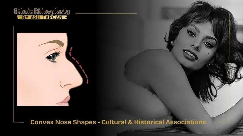 Convex Nose Shapes - Cultural & Historical Associations Convex Nose Shapes - Cultural & Historical Associations