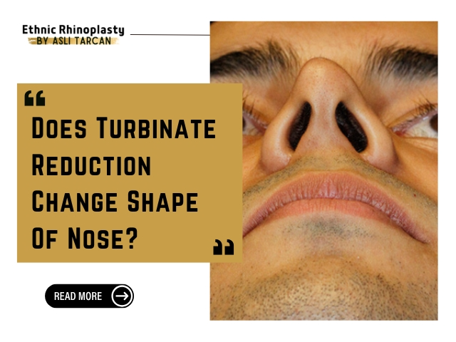 Does Turbinate Reduction Change Shape Of Nose