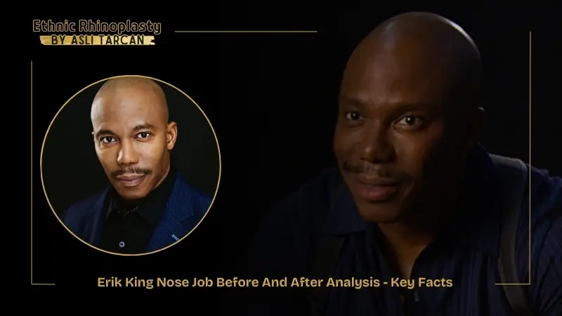 Erik King Nose Job Before And After Analysis - Key Facts Erik King Nose Job Before And After Analysis - Key Facts