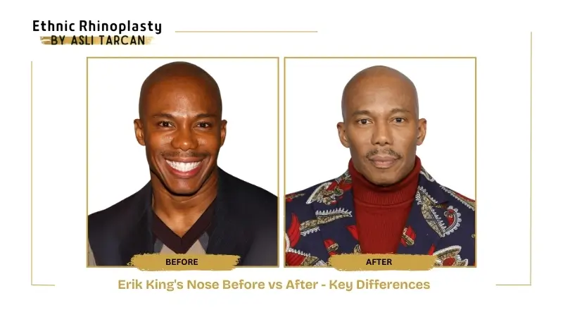 Erik King's Nose Before vs After - Key Differences Erik King's Nose Before vs After - Key Differences
