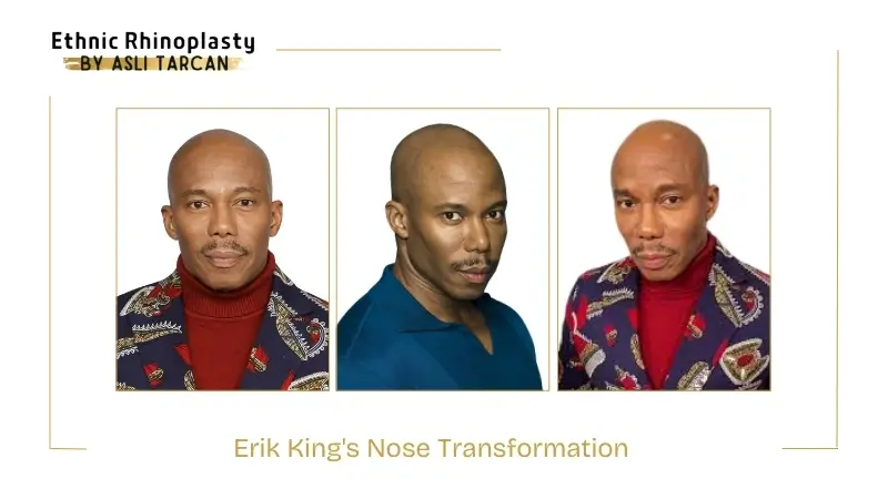 Erik King's Nose Transformation Erik King's Nose Transformation