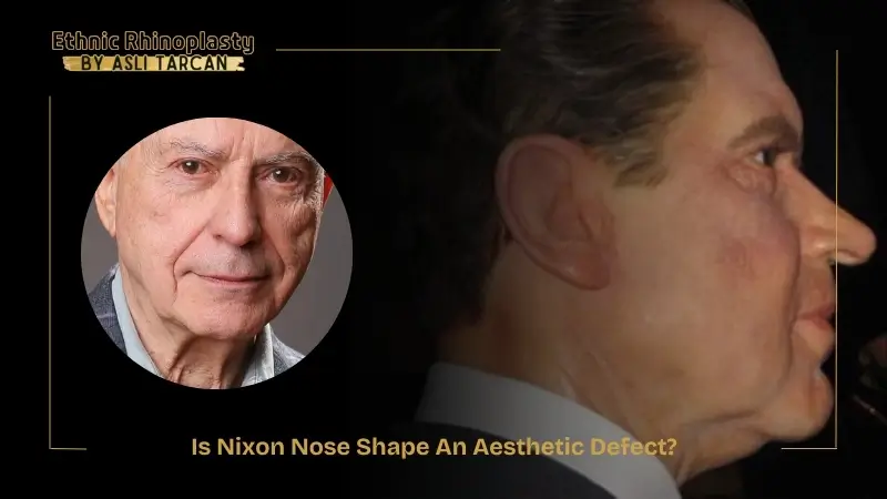 Is Nixon Nose Shape An Aesthetic Defect Is Nixon Nose Shape An Aesthetic Defect