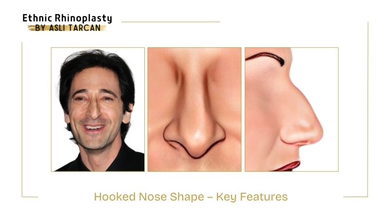 Key features of Hooked Nose Shape Key features of Hooked Nose Shape