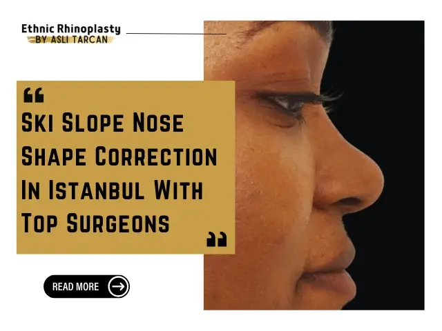 Ski Slope Nose Shape