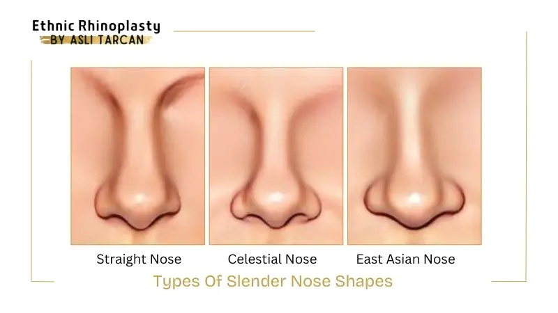 Types Of Slender Nose Shapes Types Of Slender Nose Shapes