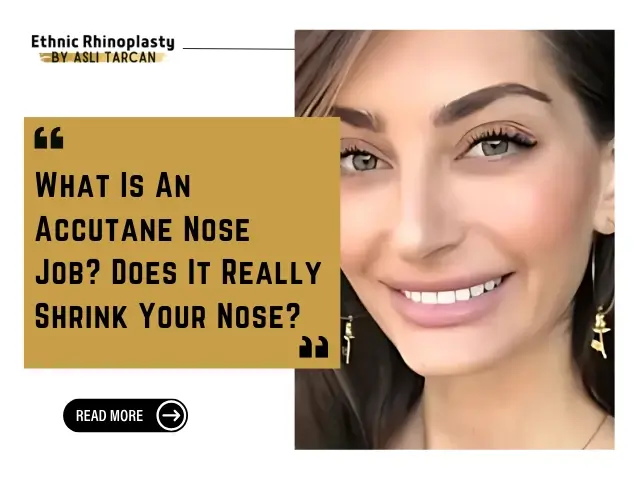 What Is An Accutane Nose Job