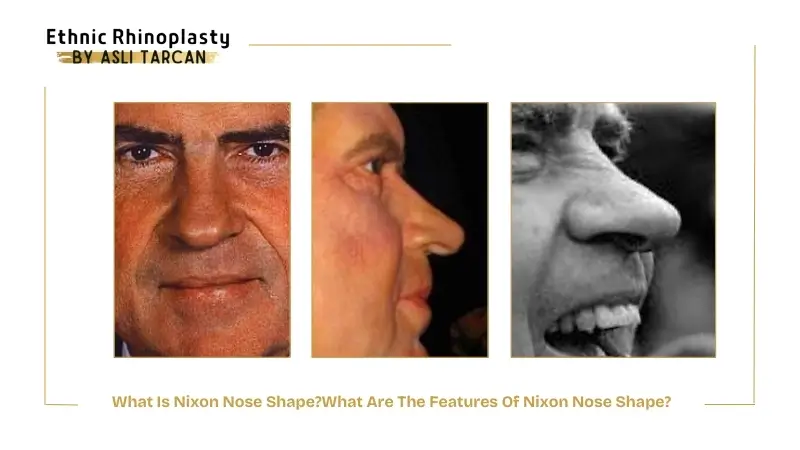 What Is Nixon Nose Shape Unique Features And Famous Faces What Is Nixon Nose Shape Unique Features And Famous Faces