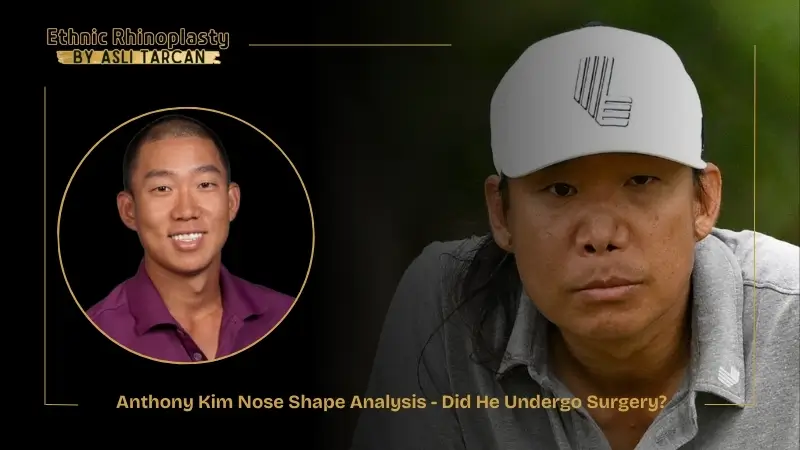 Anthony Kim Nose Shape Analysis - Did He Undergo Surgery Anthony Kim Nose Shape Analysis - Did He Undergo Surgery