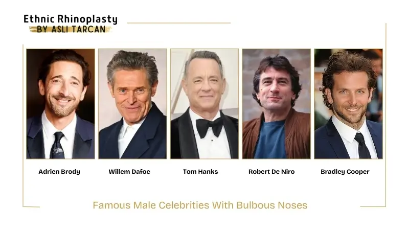 Famous Male Celebrities With Bulbous Noses Famous Male Celebrities With Bulbous Noses