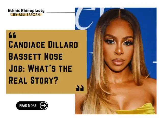 Candiace Dillard Bassett Nose Job