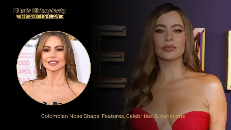 Colombian Nose Shape Features, Celebrities & Variations Colombian Nose Shape Features, Celebrities & Variations