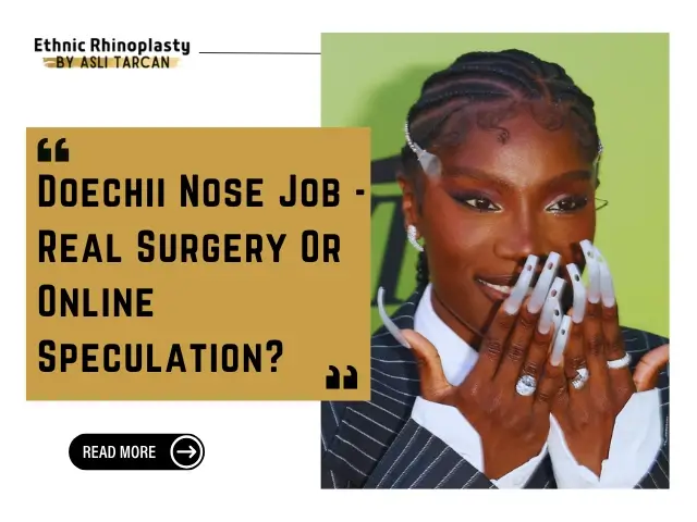 Doechii Nose Job