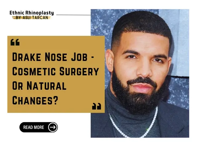 Drake Nose Job