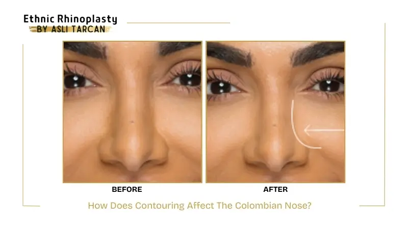 How Does Contouring Affect The Colombian Nose How Does Contouring Affect The Colombian Nose