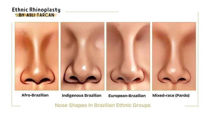Nose Shapes In Brazilian Ethnic Groups Nose Shapes In Brazilian Ethnic Groups