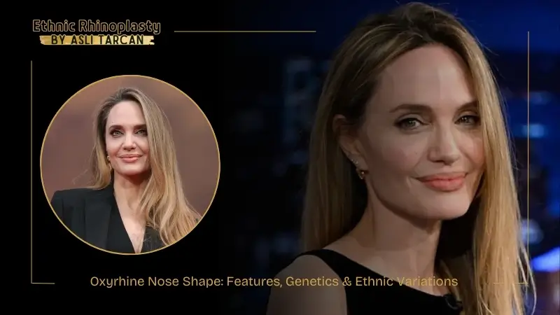 Oxyrhine Nose Shape Features