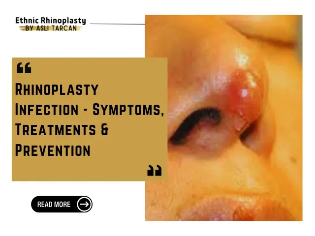 Rhinoplasty Infection