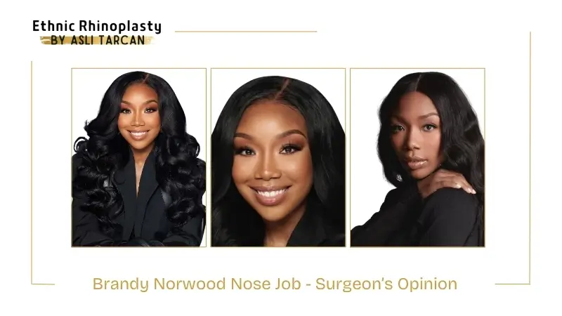 Brandy Norwood Nose Job - Surgeon’s Opinion Brandy Norwood Nose Job - Surgeon’s Opinion