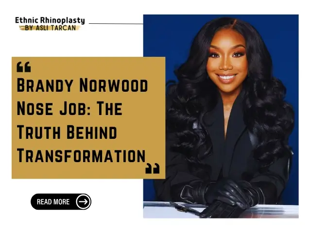 Brandy Norwood Nose Job