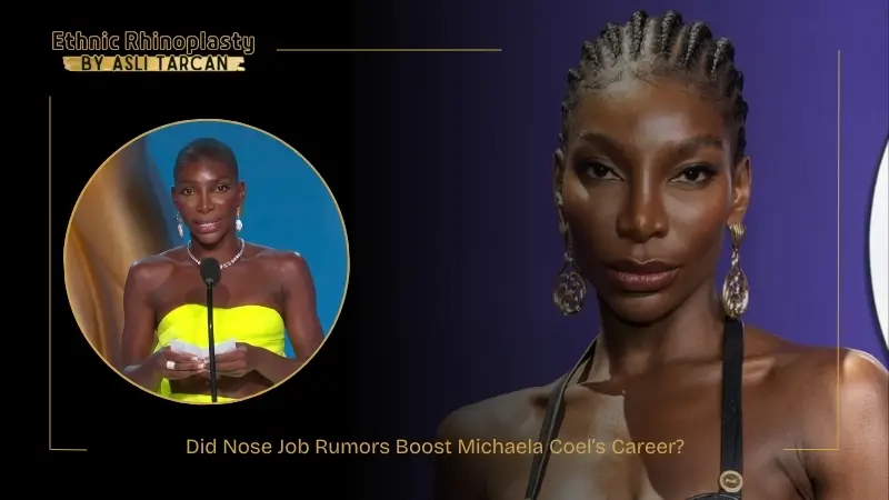 Did Nose Job Rumors Boost Michaela Coel’s Career Did Nose Job Rumors Boost Michaela Coel’s Career
