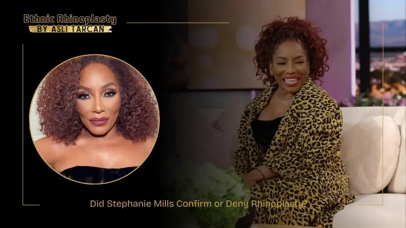 Did Stephanie Mills Confirm or Deny Rhinoplasty Did Stephanie Mills Confirm or Deny Rhinoplasty
