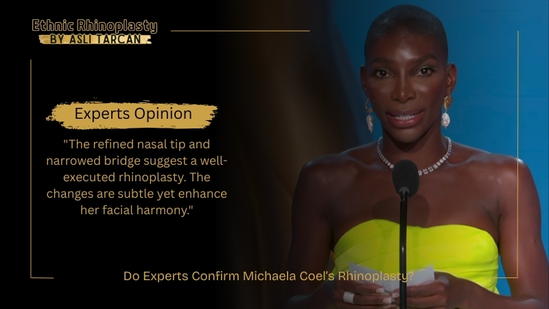 Do Experts Confirm Michaela Coel’s Rhinoplasty Do Experts Confirm Michaela Coel’s Rhinoplasty