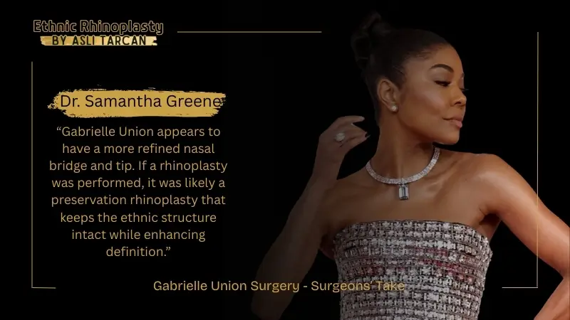 Gabrielle Union Surgery - Surgeons’ Take Gabrielle Union Surgery - Surgeons’ Take