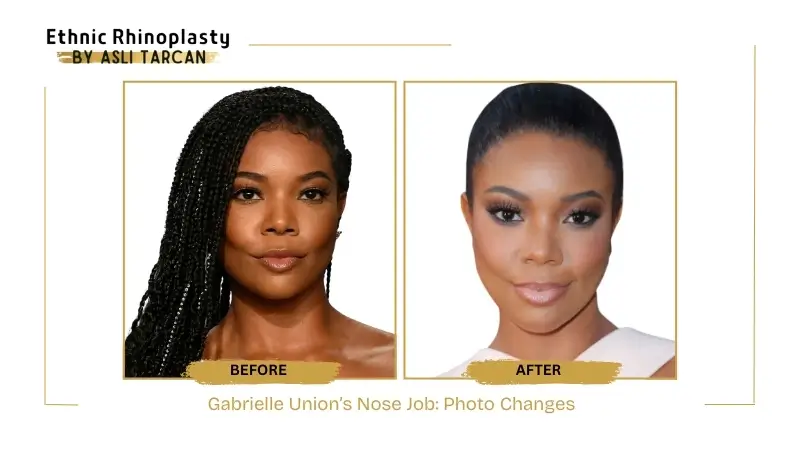 Gabrielle Union’s Nose Job Photo Changes Gabrielle Union’s Nose Job Photo Changes