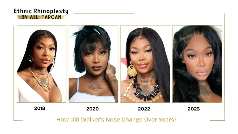 How Did Walker’s Nose Change Over Years How Did Walker’s Nose Change Over Years