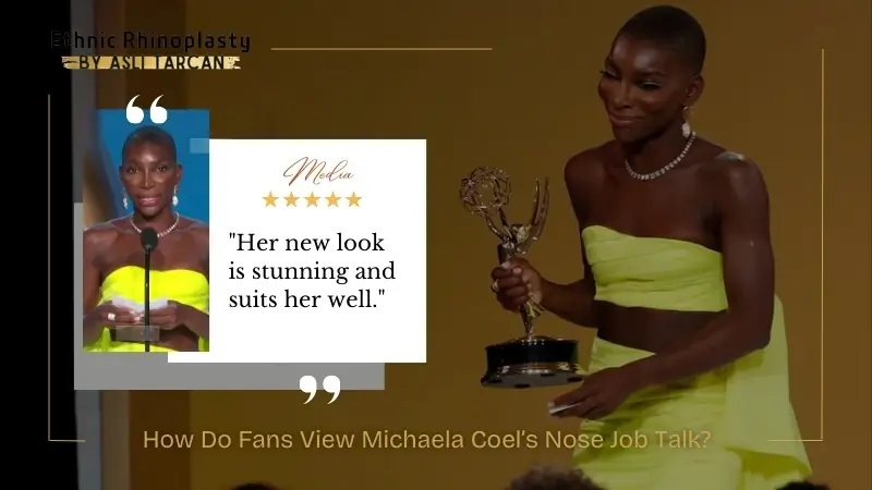 How Do Fans View Michaela Coel’s Nose Job Talk How Do Fans View Michaela Coel’s Nose Job Talk