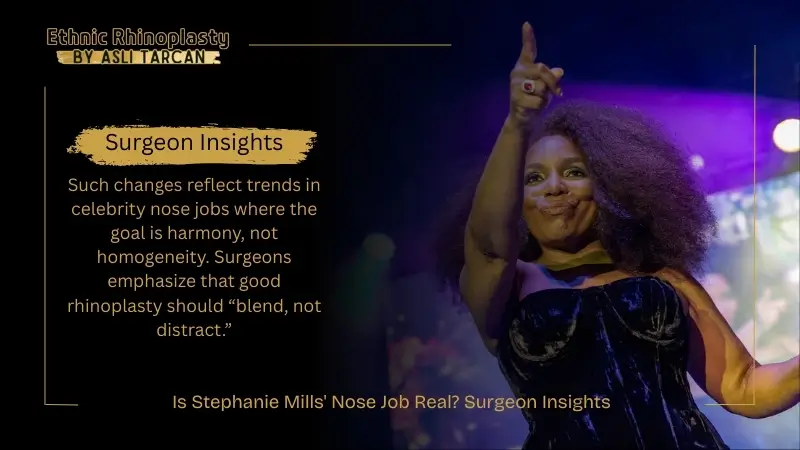 Is Stephanie Mills' Nose Job Real Surgeon Insights Is Stephanie Mills' Nose Job Real Surgeon Insights