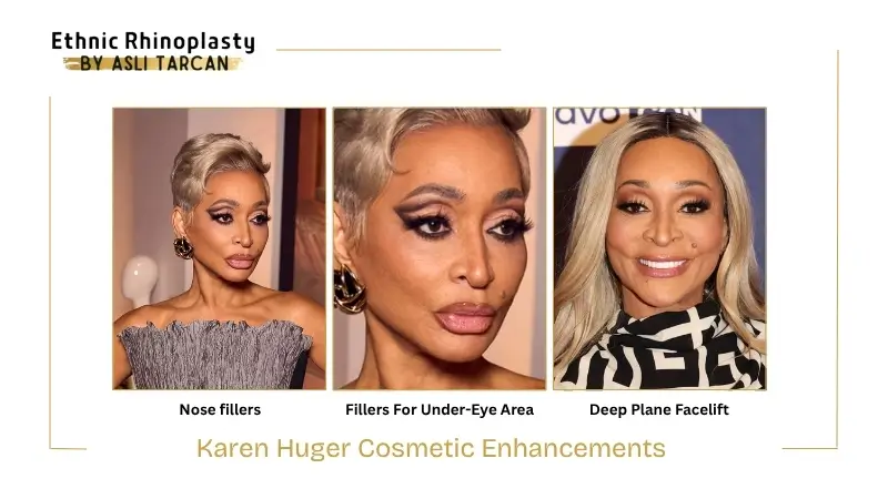 Karen Huger Cosmetic Enhancements Karen Huger Cosmetic Enhancements