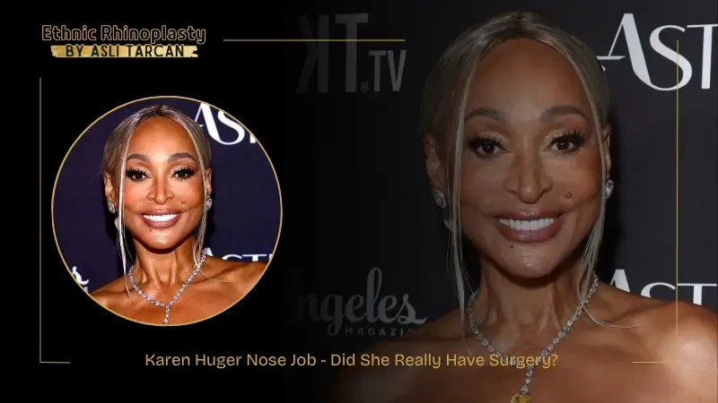 Karen Huger Nose Job - Did She Really Have Surgery Karen Huger Nose Job - Did She Really Have Surgery