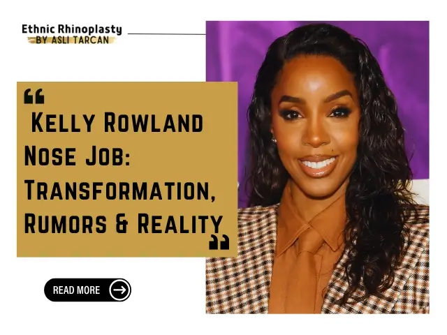 Kelly Rowland Nose Job